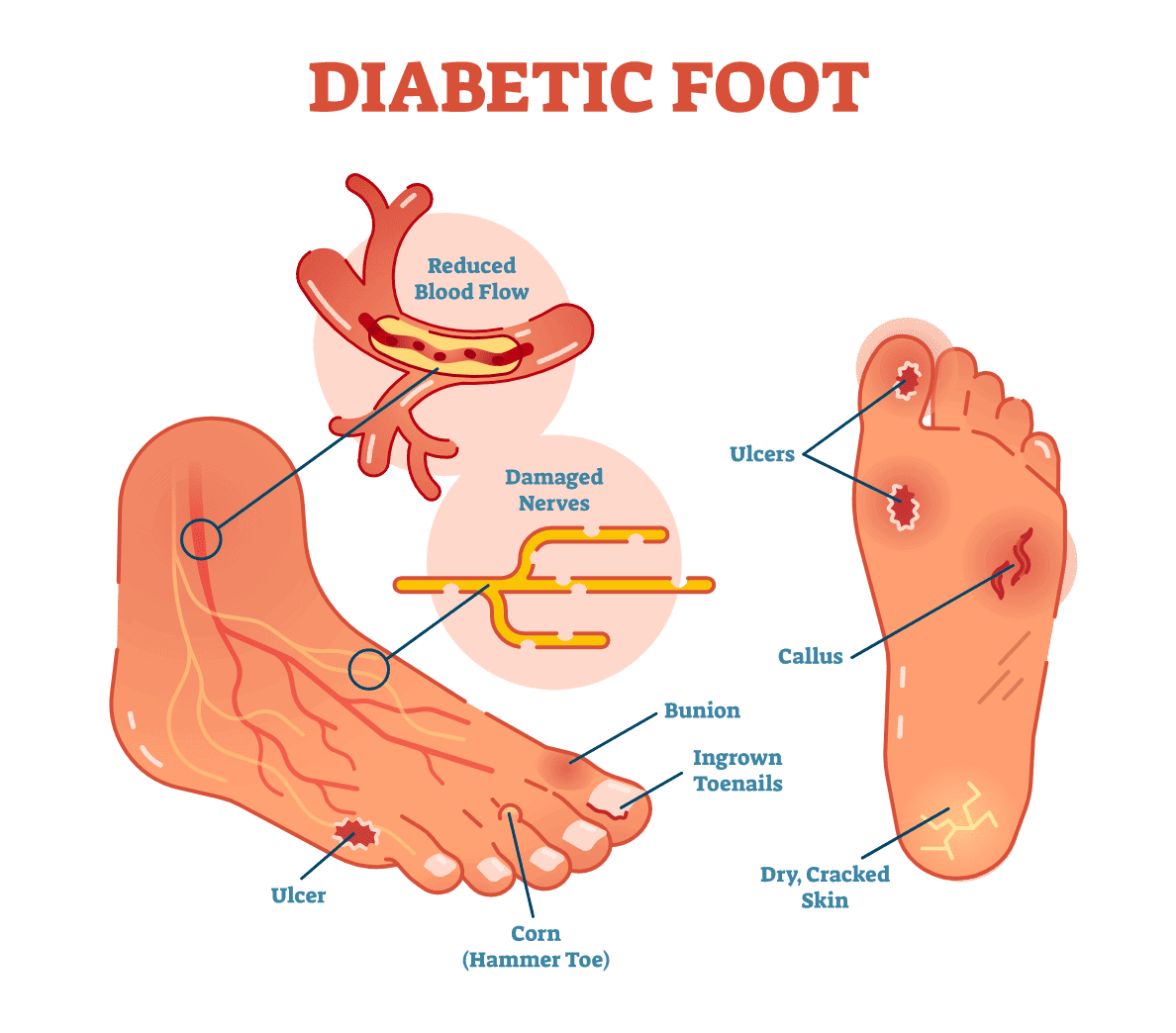 10 Simple Foot Care Tips For Beautiful Feet Indian Beauty Tips 10 Simple Foot Care Tips For Beautiful Feet Indian Beauty Tips