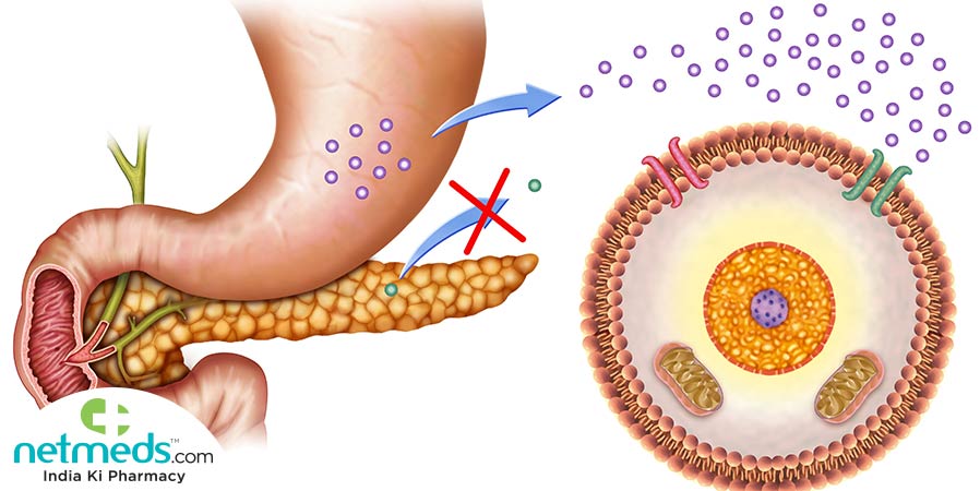 Exocrine Pancreatic Insufficiency Or Epi Survival Guide Exocrine Pancreatic Insufficiency Or Epi Survival Guide