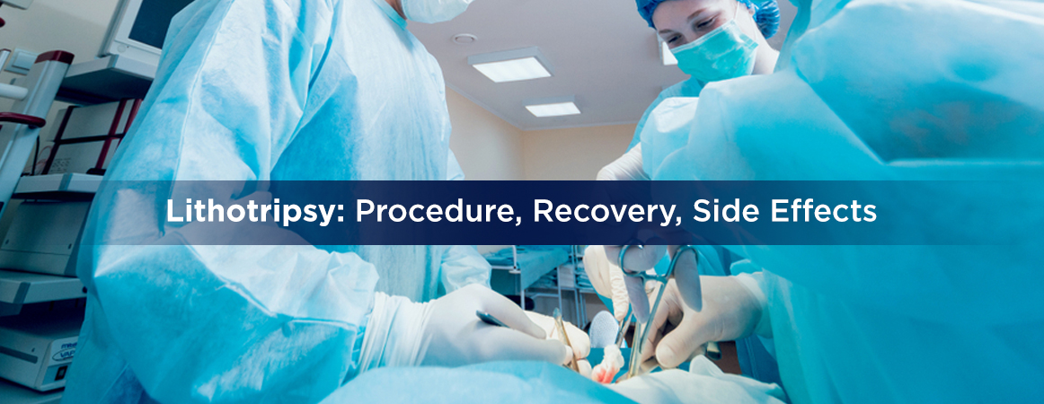 Lithotripsy Procedure Recovery And Side Effects Lithotripsy Procedure Recovery And Side Effects