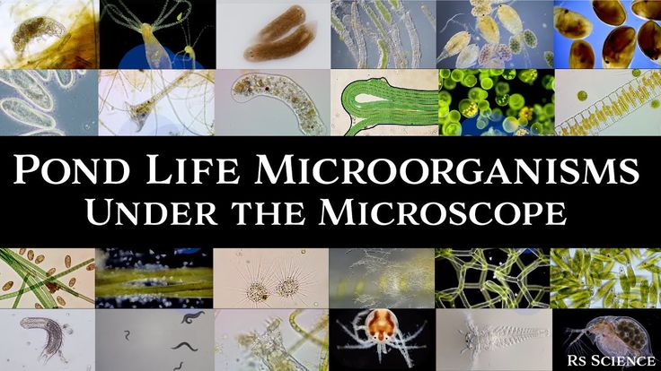 Microscopic Organisms In A Drop Of Pond Water Complete Collection Microscopic Organisms In A Drop Of Pond Water Complete Collection