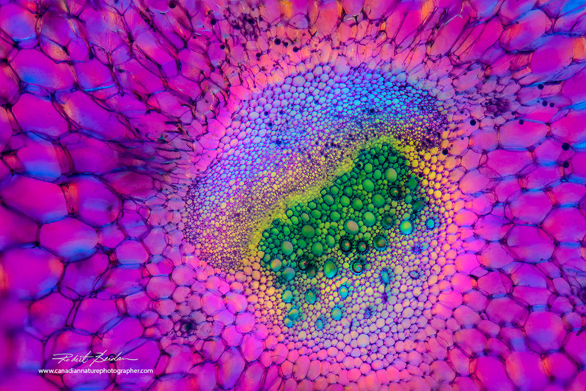 Microscopic Pond Life Photography By Robert Berdan The Canadian Microscopic Pond Life Photography By Robert Berdan The Canadian
